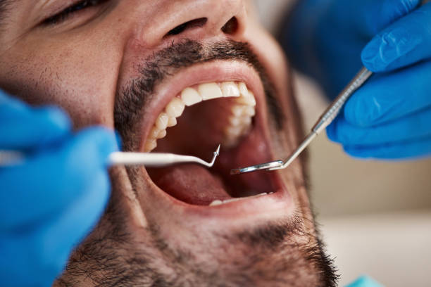 Best Chipped Tooth Repair Near Me  in Troy Hills, NJ